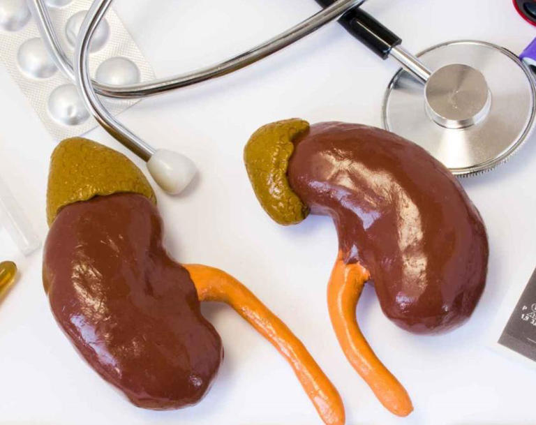 每吃一次肾坏死加速?提醒这3种食物是肾“杀手” 每吃一次肾坏死加速?提醒这3种食物是肾“杀手”