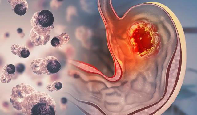 你以为的上火,可能是癌症信号,出现这4种症状,该做检查了 你以为的上火,可能是癌症信号,出现这4种症状,该做检查了