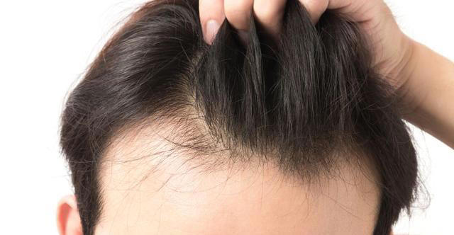 医生发现，凡是白发早生的人，大多都有2个共性，日常不妨多观察