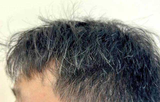 医生发现，凡是白发早生的人，大多都有2个共性，日常不妨多观察