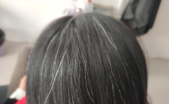 医生发现，凡是白发早生的人，大多都有2个共性，日常不妨多观察