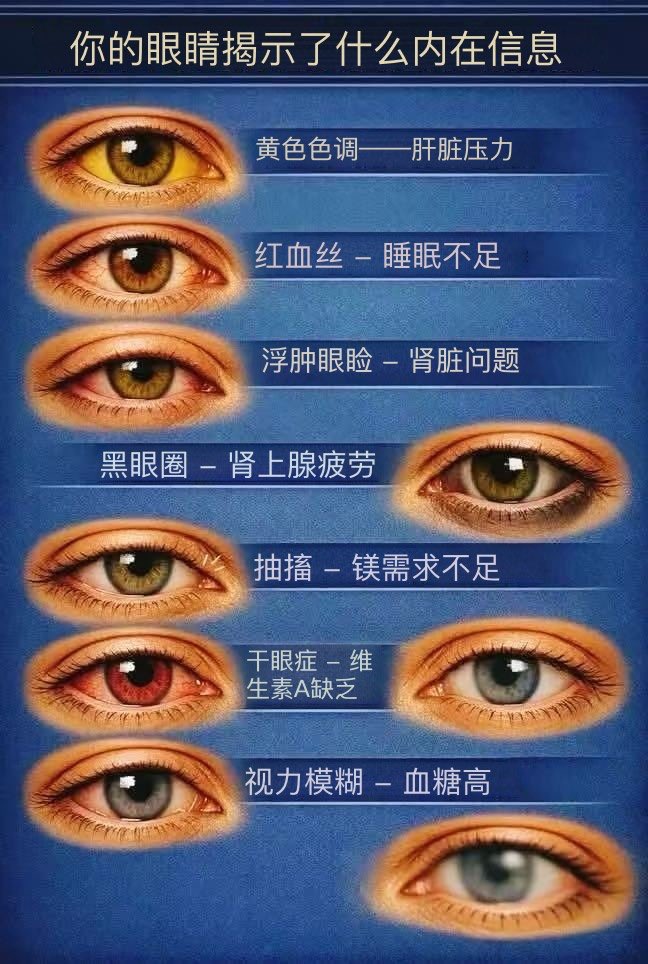 眼睛状态